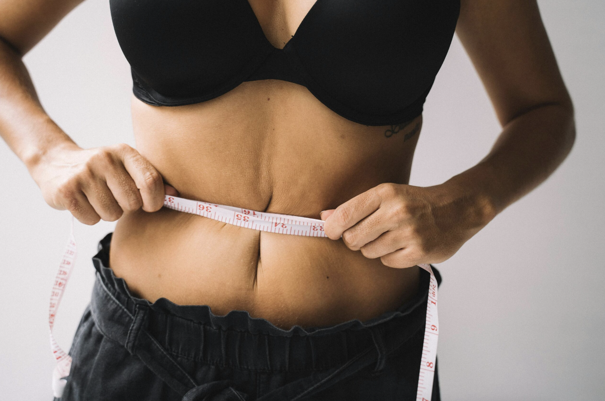 You Lost the Weight, Now What? Removing Excess Skin After Weight Loss